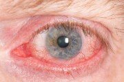 cataracts, statin drugs
