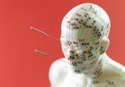 acupuncture, alternative therapies